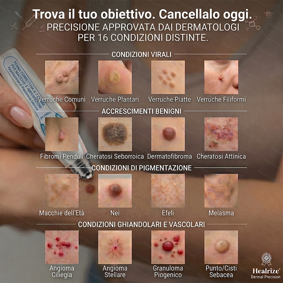 🔥 Rimaste solo 10 confezioni! Ottieni un ulteriore sconto del 30%.✅𝑯𝗲𝙖𝐥𝒓𝗶𝙯𝗲® 𝐂𝐚𝐧𝐜𝐞𝐥𝐥𝐚 𝐕𝐞𝐫𝐫𝐮𝐜𝐡𝐞 & 𝐈𝐦𝐩𝐞𝐫𝐟𝐞𝐳𝐢𝐨𝐧𝐢 𝐢𝐧 𝟕 𝐆𝐢𝐨𝐫𝐧𝐢🪄(𝙍𝙤𝙡𝙡𝙚𝙧𝙗𝙖𝙡𝙡 𝙎𝙚𝙣𝙯𝙖 𝘿𝙤𝙡𝙤𝙧𝙚, 𝙎𝙚𝙣𝙯𝙖 𝘾𝙞𝙘𝙖𝙩𝙧𝙞𝙘𝙞)👩‍⚕️