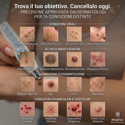 🔥 Rimaste solo 10 confezioni! Ottieni un ulteriore sconto del 30%.✅𝑯𝗲𝙖𝐥𝒓𝗶𝙯𝗲® 𝐂𝐚𝐧𝐜𝐞𝐥𝐥𝐚 𝐕𝐞𝐫𝐫𝐮𝐜𝐡𝐞 & 𝐈𝐦𝐩𝐞𝐫𝐟𝐞𝐳𝐢𝐨𝐧𝐢 𝐢𝐧 𝟕 𝐆𝐢𝐨𝐫𝐧𝐢🪄(𝙍𝙤𝙡𝙡𝙚𝙧𝙗𝙖𝙡𝙡 𝙎𝙚𝙣𝙯𝙖 𝘿𝙤𝙡𝙤𝙧𝙚, 𝙎𝙚𝙣𝙯𝙖 𝘾𝙞𝙘𝙖𝙩𝙧𝙞𝙘𝙞)👩‍⚕️